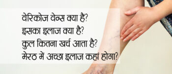 Varicose Veins Treatment in Meerut: नसों के गुच्छे का Best समाधान मात्र 3 घंटे में