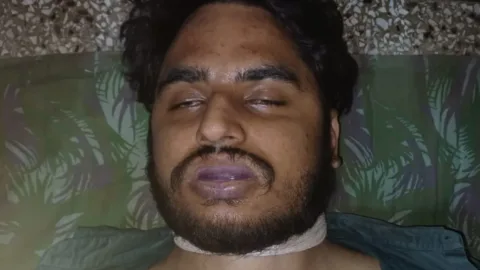 चाचा के घर पर आए युवक ने दी जान