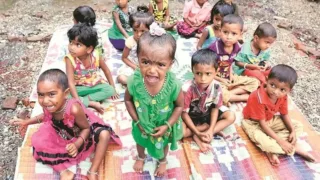 विकास के दावों के बीच बच्चों का कुपोषण